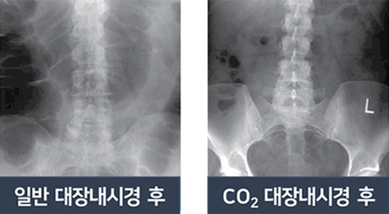 내시경센터