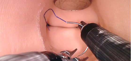 다관절 로봇팔을 이용한 고난도 수술