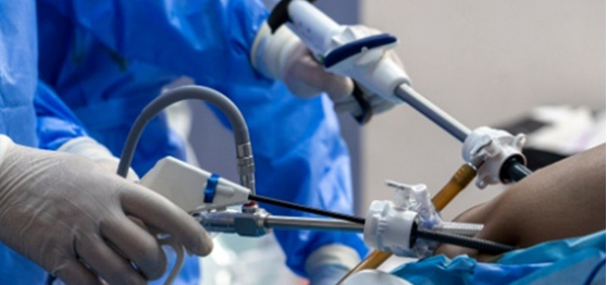 단일통로 복강경 수술의 선두주자