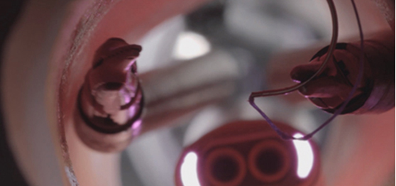 최첨단 로봇과 숙련된 의료진 집도